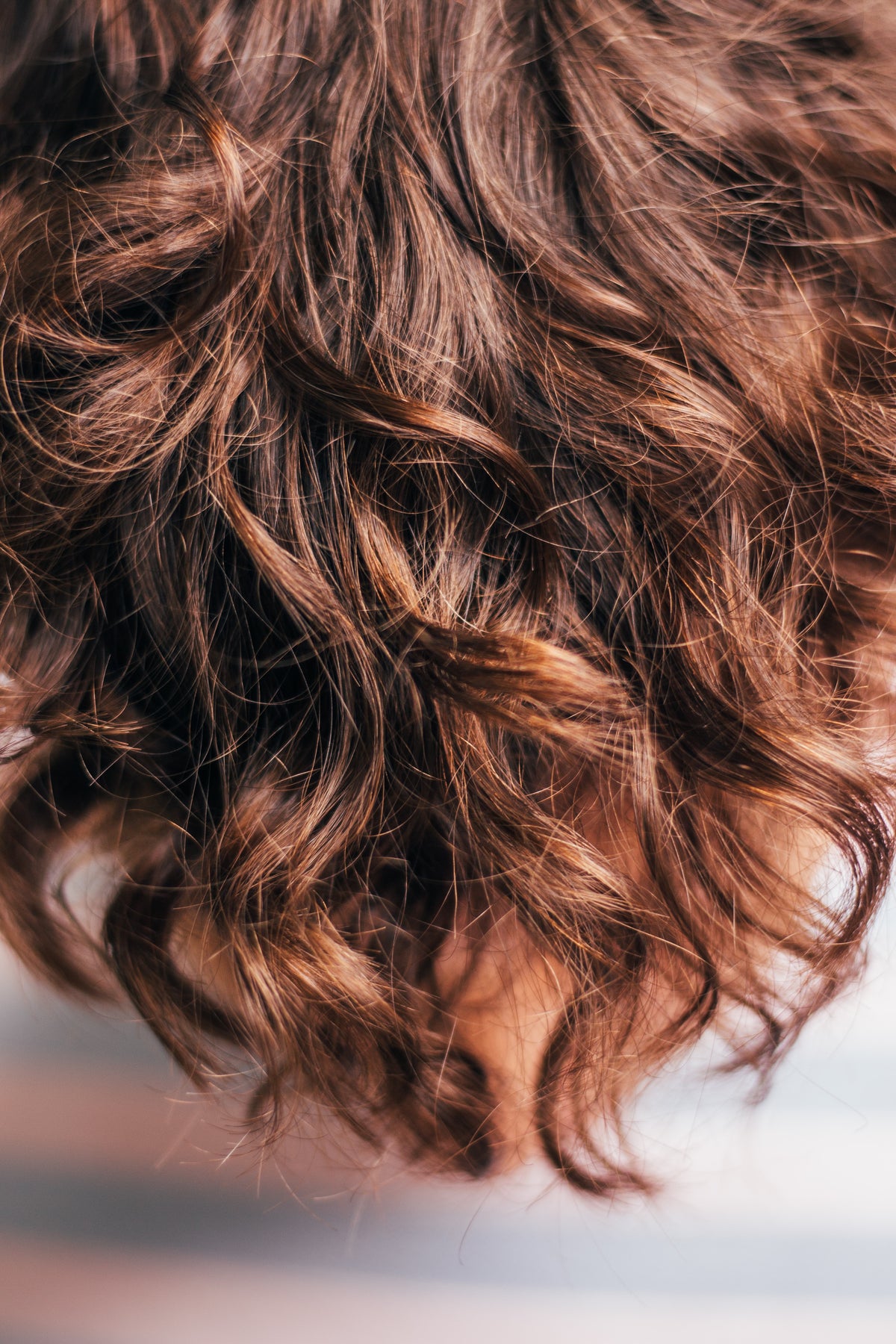 Is hair loss a vitamin D deficiency symptom?