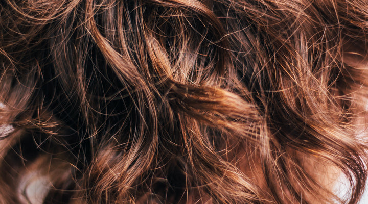 Vitamin D Deficiency and Hair Loss